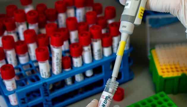 Український бізнес активно включився в боротьбу з COVID-19