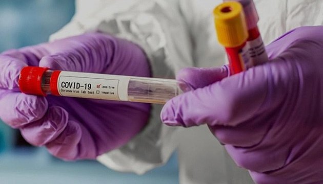 Україна виявилася не готовою до другої хвилі пандемії